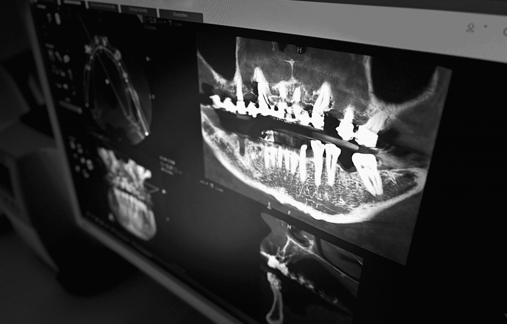 services bild - digitales röntgen
