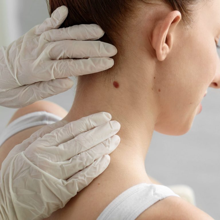 OP-Situation: „Chirurgische Entfernung eines Hauttumors im Kopf-Hals-Bereich – fachärztliche Hautkrebs-Behandlung nach Leitlinien.“